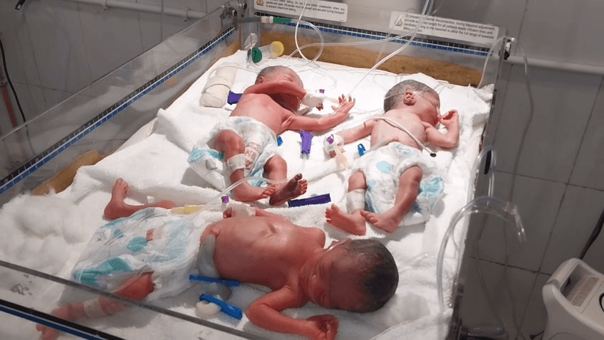 जामताड़ा में एक महिला ने तीन बच्चों को जन्म दिया