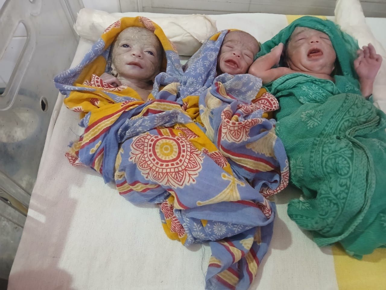 बगहा : रामनगर PHC में एक साथ तीन बच्चों का जन्म, मां और नवजात पूरी तरह स्वस्थ