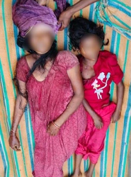 शराबी भैसुर ने गर्भवती महिला और मासूम भतीजी को कुल्हाड़ी से काटा